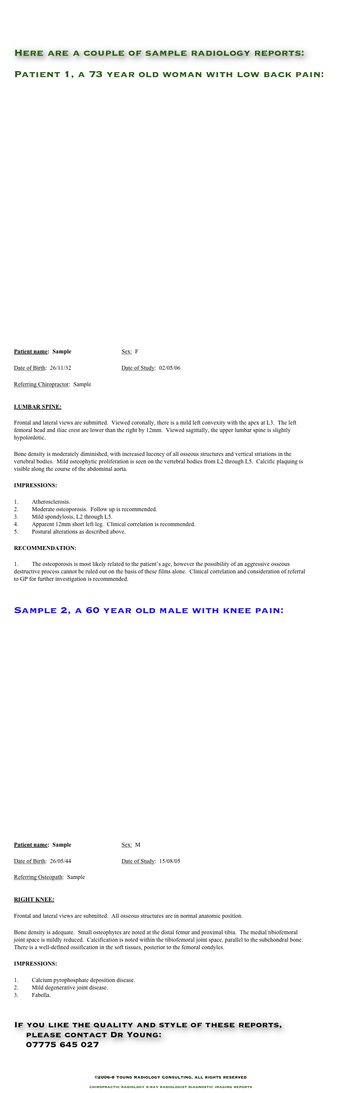 


Here are a couple of sample radiology reports:

Patient 1, a 73 year old woman with low back pain:

























Patient name:  Sample	 	Sex:  F

Date of Birth:  26/11/32		Date of Study:  02/05/06

Referring Chiropractor:  Sample	 


LUMBAR SPINE:

Frontal and lateral views are submitted.  Viewed coronally, there is a mild left convexity with the apex at L3.  The left femoral head and iliac crest are lower than the right by 12mm.  Viewed sagittally, the upper lumbar spine is slightly hypolordotic.  

Bone density is moderately diminished, with increased lucency of all osseous structures and vertical striations in the vertebral bodies.  Mild osteophytic proliferation is seen on the vertebral bodies from L2 through L5.  Calcific plaquing is visible along the course of the abdominal aorta.  

IMPRESSIONS:

1.	Atherosclerosis.
2.	Moderate osteoporosis.  Follow up is recommended. 
3.	Mild spondylosis, L2 through L5.
4.	Apparent 12mm short left leg.  Clinical correlation is recommended. 
5.	Postural alterations as described above. 

RECOMMENDATION:
 
1.	The osteoporosis is most likely related to the patient’s age, however the possibility of an aggressive osseous destructive process cannot be ruled out on the basis of these films alone.  Clinical correlation and consideration of referral to GP for further investigation is recommended.


Sample 2, a 60 year old male with knee pain:





















Patient name:  Sample 	 	Sex:  M

Date of Birth:  26/05/44		Date of Study:  15/08/05

Referring Osteopath:  Sample	 


RIGHT KNEE:

Frontal and lateral views are submitted.  All osseous structures are in normal anatomic position.

Bone density is adequate.  Small osteophytes are noted at the distal femur and proximal tibia.  The medial tibiofemoral joint space is mildly reduced.  Calcification is noted within the tibiofemoral joint space, parallel to the subchondral bone.  There is a well-defined ossification in the soft tissues, posterior to the femoral condyles.

IMPRESSIONS:

1.	Calcium pyrophosphate deposition disease.
2.	Mild degenerative joint disease.
3.	Fabella. 


If you like the quality and style of these reports, 
    please contact Dr Young:
    07775 645 027
    info@YoungRadiology.com


©2006-8 Young Radiology Consulting, all rights reserved

chiropractic radiology x-ray radiologist diagnostic imaging reports