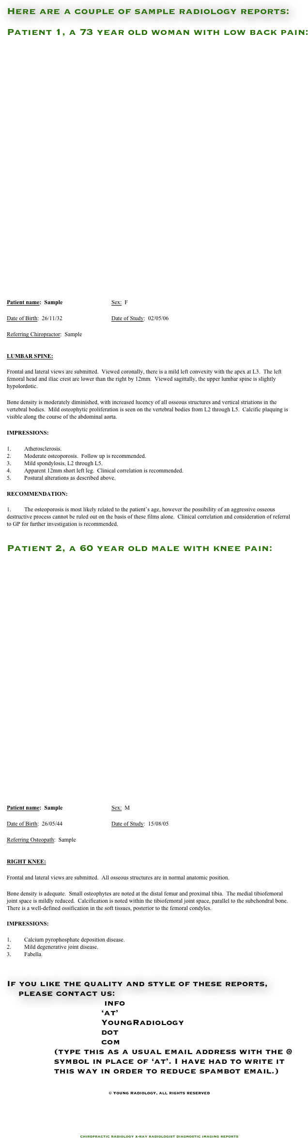 


Here are a couple of sample radiology reports:

Patient 1, a 73 year old woman with low back pain:

























Patient name:  Sample	 	Sex:  F

Date of Birth:  26/11/32		Date of Study:  02/05/06

Referring Chiropractor:  Sample	 


LUMBAR SPINE:

Frontal and lateral views are submitted.  Viewed coronally, there is a mild left convexity with the apex at L3.  The left femoral head and iliac crest are lower than the right by 12mm.  Viewed sagittally, the upper lumbar spine is slightly hypolordotic.  

Bone density is moderately diminished, with increased lucency of all osseous structures and vertical striations in the vertebral bodies.  Mild osteophytic proliferation is seen on the vertebral bodies from L2 through L5.  Calcific plaquing is visible along the course of the abdominal aorta.  

IMPRESSIONS:

1.	Atherosclerosis.
2.	Moderate osteoporosis.  Follow up is recommended. 
3.	Mild spondylosis, L2 through L5.
4.	Apparent 12mm short left leg.  Clinical correlation is recommended. 
5.	Postural alterations as described above. 

RECOMMENDATION:
 
1.	The osteoporosis is most likely related to the patient’s age, however the possibility of an aggressive osseous destructive process cannot be ruled out on the basis of these films alone.  Clinical correlation and consideration of referral to GP for further investigation is recommended.


Patient 2, a 60 year old male with knee pain:
























Patient name:  Sample 	 	Sex:  M

Date of Birth:  26/05/44		Date of Study:  15/08/05

Referring Osteopath:  Sample	 


RIGHT KNEE:

Frontal and lateral views are submitted.  All osseous structures are in normal anatomic position.

Bone density is adequate.  Small osteophytes are noted at the distal femur and proximal tibia.  The medial tibiofemoral joint space is mildly reduced.  Calcification is noted within the tibiofemoral joint space, parallel to the subchondral bone.  There is a well-defined ossification in the soft tissues, posterior to the femoral condyles.

IMPRESSIONS:

1.	Calcium pyrophosphate deposition disease.
2.	Mild degenerative joint disease.
3.	Fabella. 


If you like the quality and style of these reports, 
    please contact us:
                                 info 
                                ‘at’ 
                                YoungRadiology 
                                dot 
                                com
                (type this as a usual email address with the @             
                symbol in place of ‘at’. I have had to write it 
                this way in order to reduce spambot email.)


© Young Radiology, all rights reserved








chiropractic radiology x-ray radiologist diagnostic imaging reports
